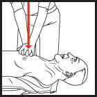 Emergency CPR Procedures | Hunter College